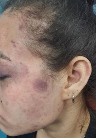 assault image